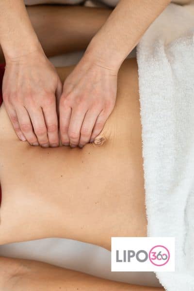 diastasis recti treatment Rowley Regis